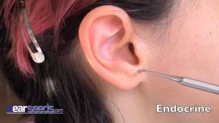 Endocrine Auriculotherapy Ear Point [upl. by Nahk628]