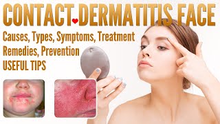 Contact Dermatitis Face Causes Types Symptoms Treatment Prevention Home Remedies [upl. by Akierdna110]