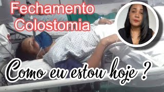 REVERSÃO DE COLOSTOMIA COMO EU ESTOU HOJE [upl. by Ainafets]