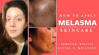 How to apply Melasma treatment creams  Nipun Kapur [upl. by Anev]