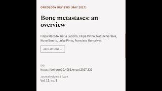 Bone metastases an overview  RTCLTV [upl. by Salhcin]