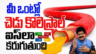 కొలెస్టరాల్‌ని ఐస్‌లా కరిగిస్తుంది  Bad Cholesterol Burning Tips  Reduces Waste Fat  Weight Loss [upl. by Westphal706]