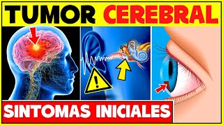 Signos Y Síntomas Iniciales De Un Tumor Cerebral  Cancer Cerebral Sintomas Tumor De Cerebro [upl. by Meave]