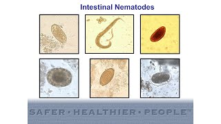 Diagnostic Features of Intestinal Nematodes [upl. by Suivatal764]