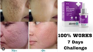 The Derma Co Niacinamide Serum Demo amp Review  How To Use Niacinamide Serum For Acne Scars marks [upl. by Orhtej]