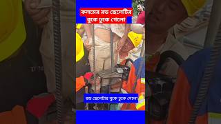 কলমের রড ছেলেটির বুকে ঢুকে গেলোconcrete construction working plan work shorts viral trending [upl. by Rainger]