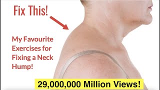 How to Fix a Neck Hump at Home FAST  With FREE Exercise Sheet [upl. by Ahseyn]