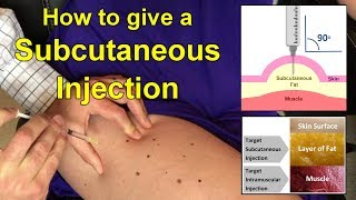 How to Give a Subcutaneous Injection Video [upl. by Zenia]