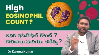 Reasons for High Eosinophil Counts  How to Reduce Eosinophils  Dr Karuna Kumar Hematologist [upl. by Elwin]