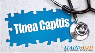 Tinea Capitis ¦ Treatment and Symptoms [upl. by Sillyrama]