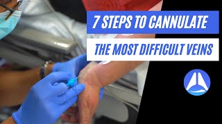 7 steps to cannulate the most difficult veins Live demonstration [upl. by Odlanir]