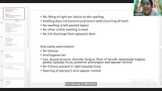 PG CLINICS CARCINOMA BREAST PAROTID TUMOUR [upl. by Neeruam565]