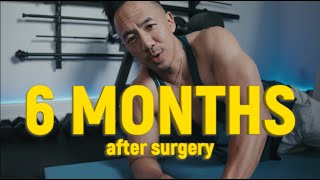 HERNIA SURGERY UPDATE  6 Months Later [upl. by Assira]