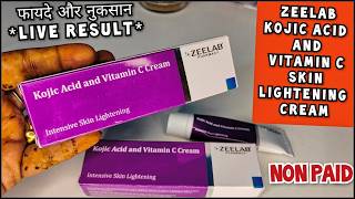 Zeelab Kojic Acid Vitamin C Cream  Kojic acid and vitamin c cream  Honest Review sale review [upl. by Euqor]