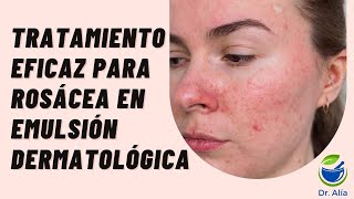 Crema para Rosácea Pápulopustulosa con Metronidazol Ivermectina y Alfa Bisabolol [upl. by Kelda]