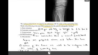 USMLE S2CK Uworld case no 31Osteochondroma [upl. by Fabi837]