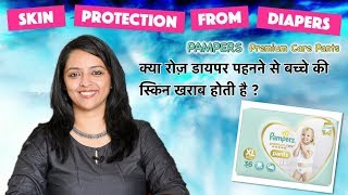 क्या रोज़ डायपर पहनने से बच्चे की स्किन खराब होती है  PROTECT BABY SKIN FROM DAILY DIAPER USE [upl. by Cirderf]