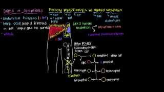 What is primary myelofibrosis [upl. by Eimmat805]