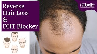 Reverse Hair Loss amp DHT Blocker  Role of DHT in Hair loss  DHT Blockers to Stop Hair loss  DHT [upl. by Hgiellek]