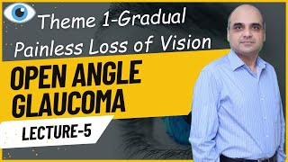 Open Angle Glaucoma Lecture 5 [upl. by Reppart562]