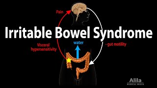 Irritable Bowel Syndrome Pathophysiology Symptoms Causes Diagnosis and Treatment Animation [upl. by Shanks]