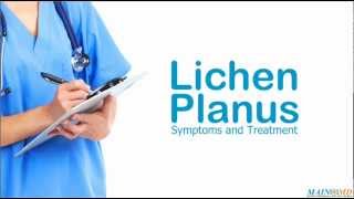 Lichen Planus Symptoms and Treatment [upl. by Attehcnoc]