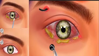 Eye tretmen pircing Asmr🙏Eye tretment pircing indiaEzafi asmr [upl. by Melina40]