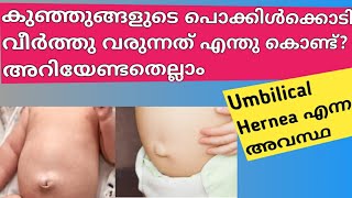 Umbilical Hernea in newborn Babies Malayalam Umbilical Hernea in infants Umbilical Hernea [upl. by Gnuj408]