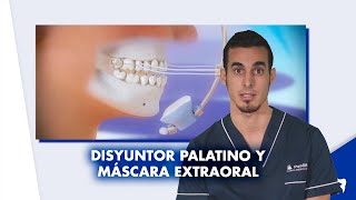 DISYUNTOR PALATINO y MÁSCARA facial de ORTODONCIA  Preguntas frecuentes  Shorts [upl. by Phyllis]