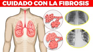 SEÑALES DE ALARMA de que tienes fibrosis pulmonar como vivir con ella y tratamiento [upl. by Ecenahs]