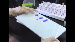 Testing Eggs for Salmonella at UMaine [upl. by Ssew271]