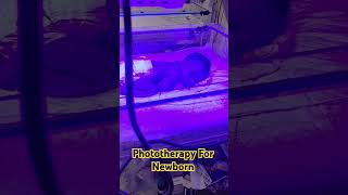 Phototherapy For Newborn Baby ytshorts trending shorts viralshorts shortsviral new jaundice [upl. by Ynohtnaed]