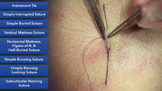 Learn How To Suture  Best Suture Techniques and Training [upl. by Adrianna]