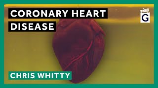 Coronary Heart Disease [upl. by Ellertnom]