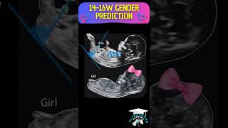 How to Determine Fetal Gender by Genital Tubercle Angle  Quick Guide [upl. by Hazaki31]