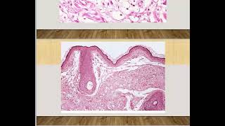 Lid Tumor quotClinical Partquot  Ophthalmology Lecture for fellowship [upl. by Loraine481]