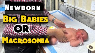 Big Babies or Macrosomia Causes and Complications in UrduHindi [upl. by Lashar]