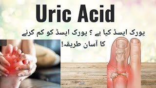 uric Acid kia haiUric Acid ka ilajUric Acid Treatment in UrduHindi How to Reduce Uric Acid [upl. by Leontyne894]