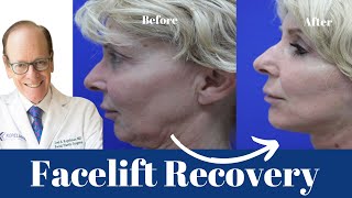 Facelift Recovery A Comprehensive Guide  Dr Joel Kopelman [upl. by Ravel]