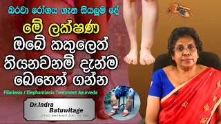 Filariasis Sinhala Lymphatic filariasis  කකුලක් ඉදිමීම ඇග කැසීම බරවා රෝගයේ ලක්ෂණයක් විය හැකියි [upl. by Beaufort107]