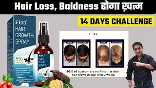 FEG Hair Growth Spray 14 Day Challenge for Longer Thicker Healthier Hair Stop Hair Loss [upl. by Ong]