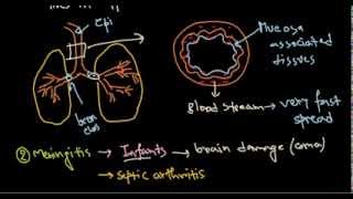 Haemophilus influenzae infection [upl. by Audra]