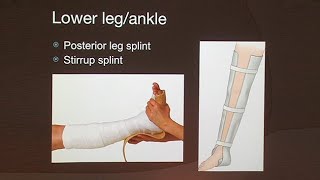 Splinting and Evacuation [upl. by Susann450]