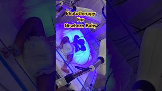 Phototherapy For Newborn  ytshorts shorts viralvideo trending phototherapy jaundice [upl. by Buchbinder]