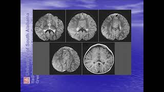 ultrasound radiologysonology [upl. by Samaj846]