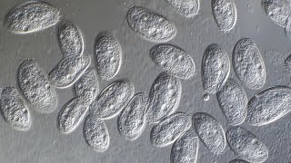 Stylonychia and Chlamydodon population bursts [upl. by Woodson]