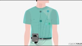 SCHILLER lenregistrement ambulatoire de lECG  Holter ECG [upl. by Brittne]