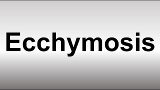 How to Pronounce Ecchymosis [upl. by Elleynod]