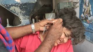 Ear cleaning heavy dirty [upl. by Most]