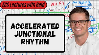 Accelerated Junctional Rhythm  Day 19 ECG Challenge [upl. by Ilwain116]